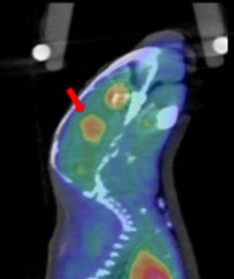 Fused PET/MRI sagittal view of a mouse glioma with an arrow marking the tumor
